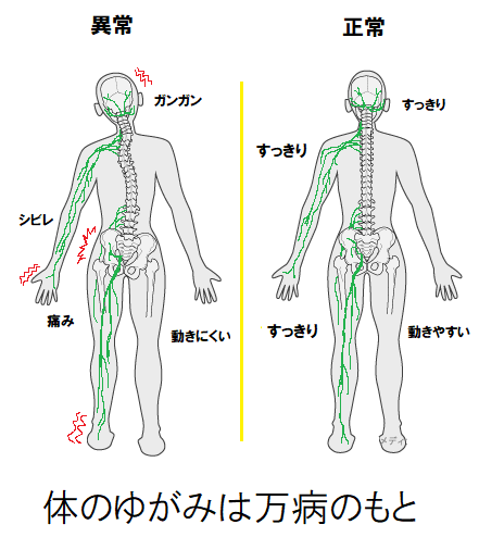 体の歪み」とは？ - 脊柱管狭窄症などでお悩みなら湖西市の整体 ときわバランス治療院