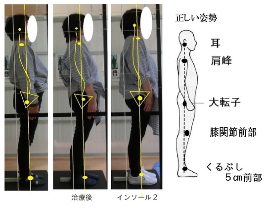 変形性股関節症・変形性膝関節症 - 脊柱管狭窄症などでお悩みなら湖西