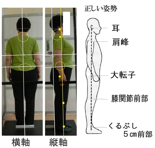 体の歪み」の診断（選） - 脊柱管狭窄症などでお悩みなら湖西市の整体 ときわバランス治療院